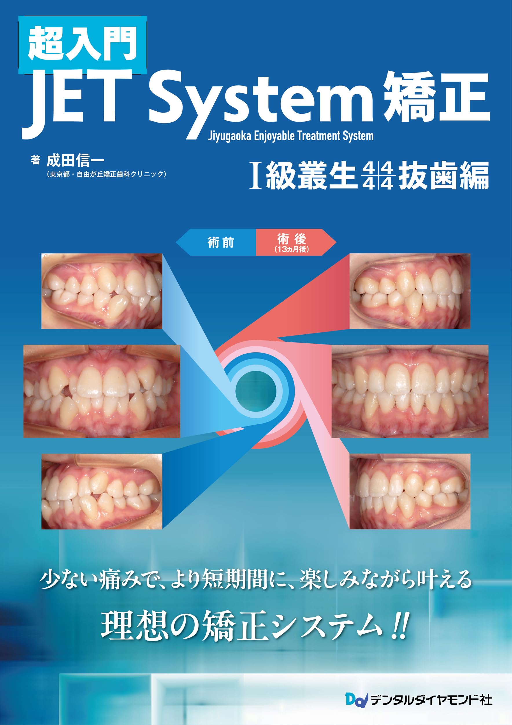 SALE～歯科、歯列矯正の本 歯列矯正がよくわかる本―歯並び大作戦 