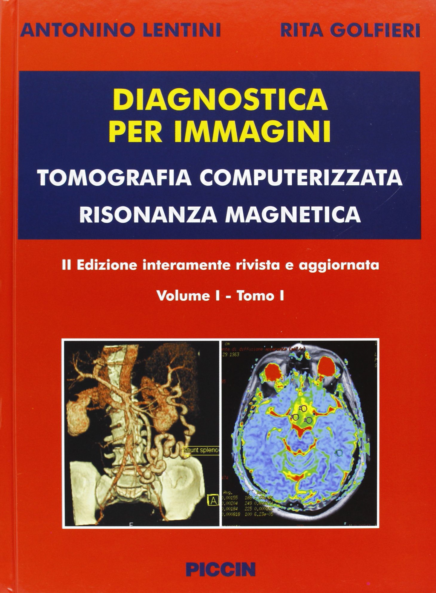 Diagnostica per immagini vol. 1/1 e 1/2. Tomografia computerizzata risonanza magnetica