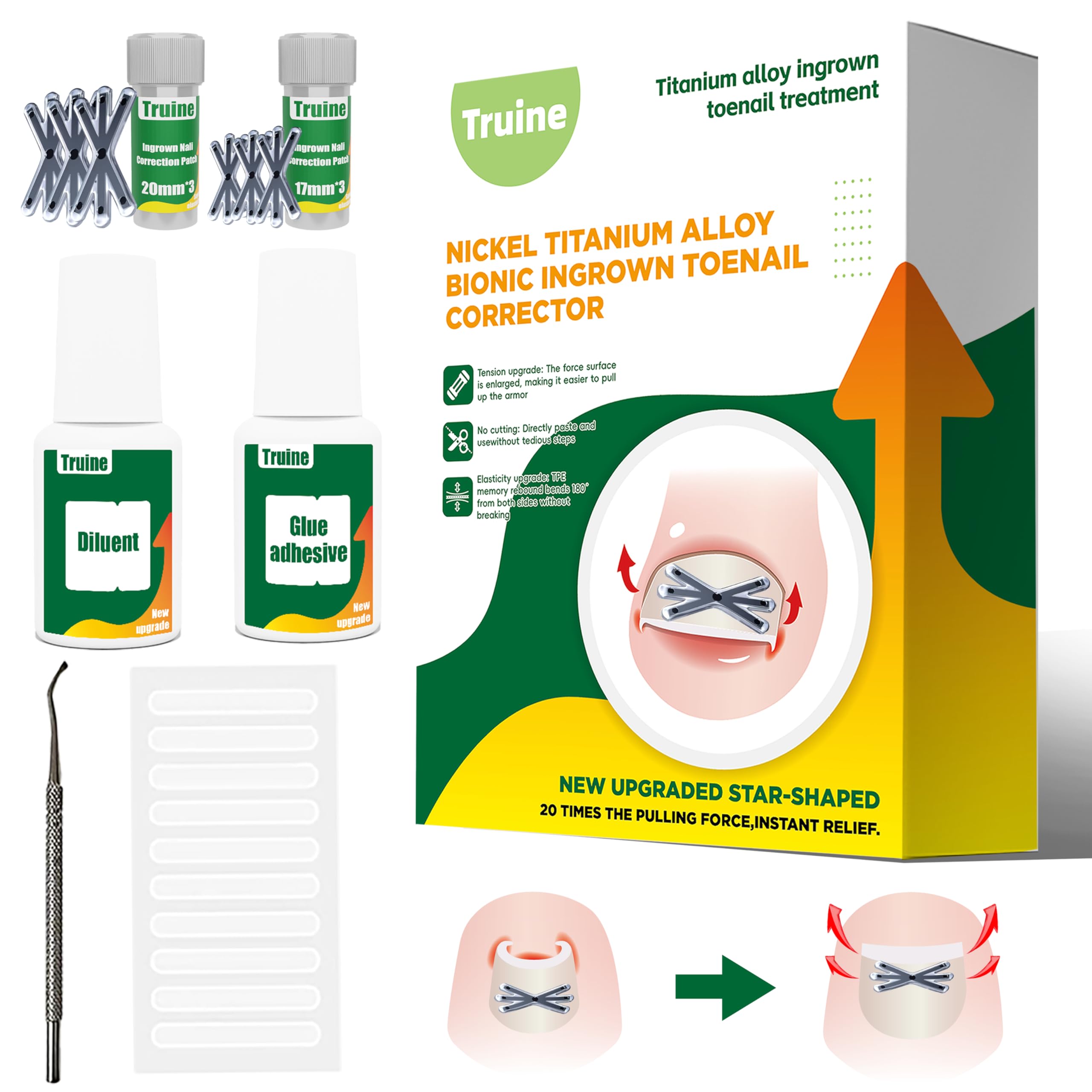 Truine Enhanced Titanium Ingrown Toenail Corrector, ingrown toenail treatment，Suitable for curved nails，ingrown toenail removal kit，at Home Ingrown