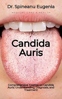Comprehensive Treatise on Candida Auris: Understanding, Diagnosis, and Treatment (Medical care and health)
