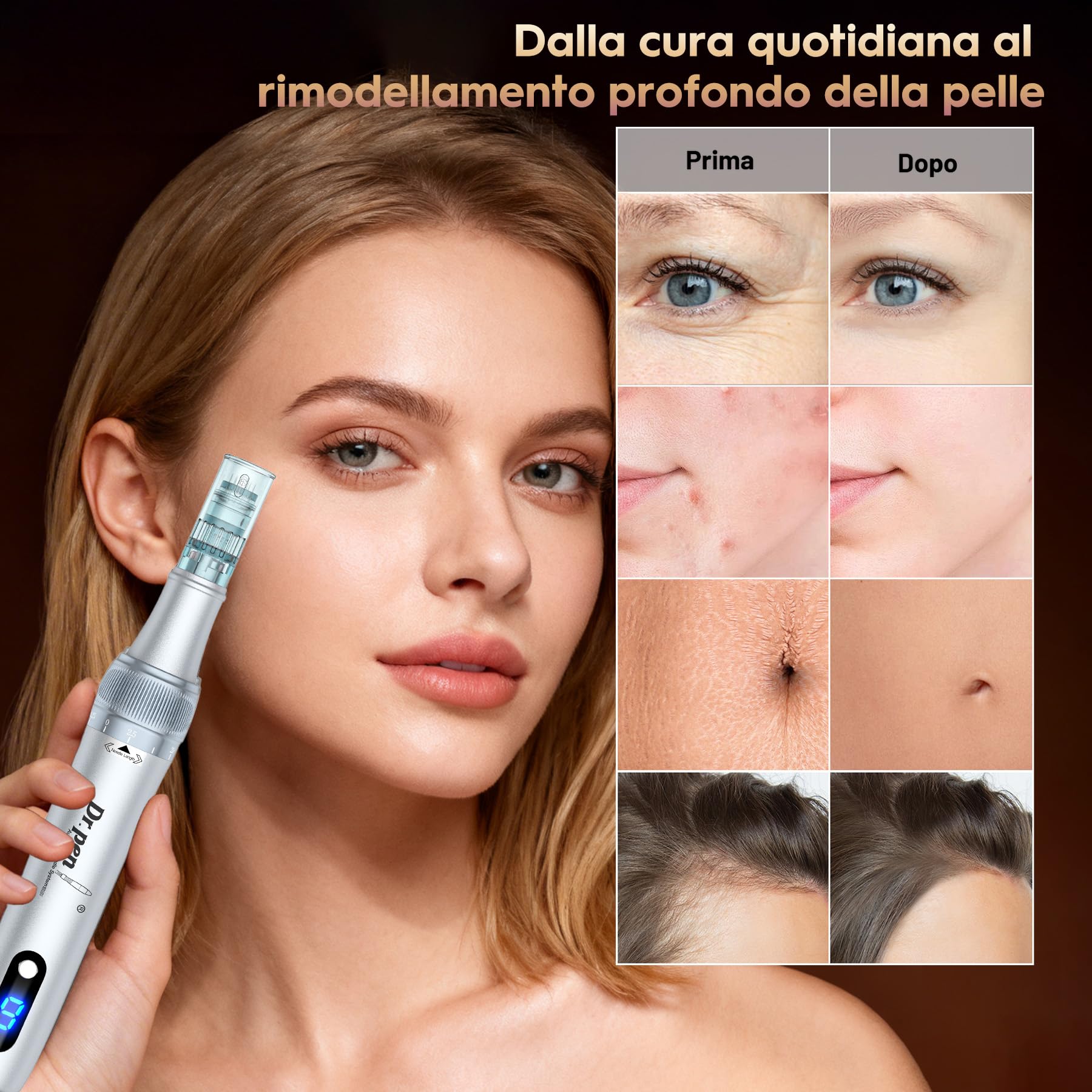 Dr. pen Ultima M7S Microneedling Pen Professionale con 20 Cartuccia di Ricambio Macchina, 6 Velocità Regolabili e Display LED, per Cura Pelle, Rughe, Cicatrici e Smagliature