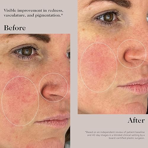 Miniatura 5 de goop Beauty Peptide Serum  Reduce líneas finas, arrugas y manchas oscuras  Péptidos, ceramidas y niacinamida  Tratamiento antienvejecimiento para