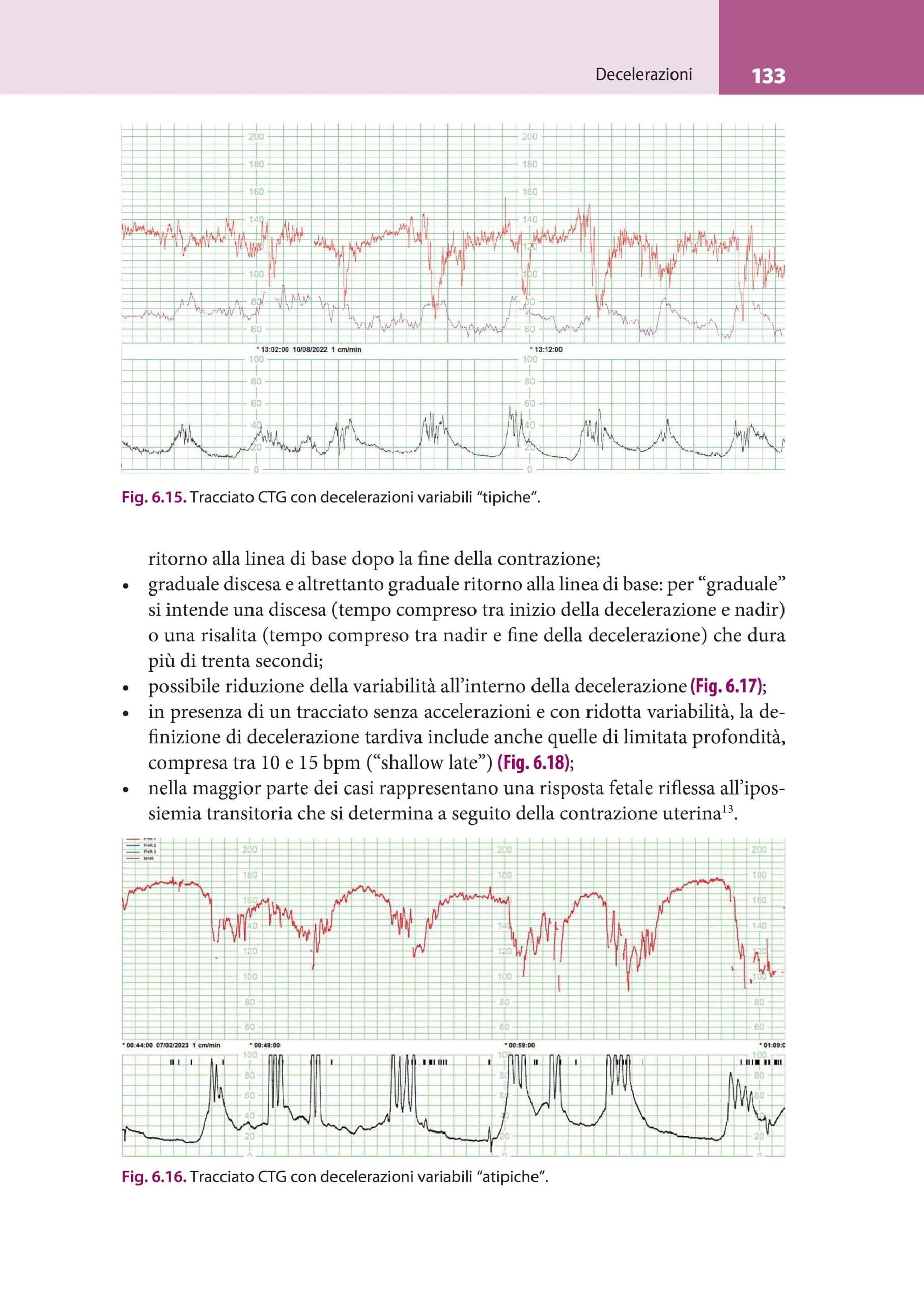 La lettura fisiopatologica della cardiotocografia intrapartum