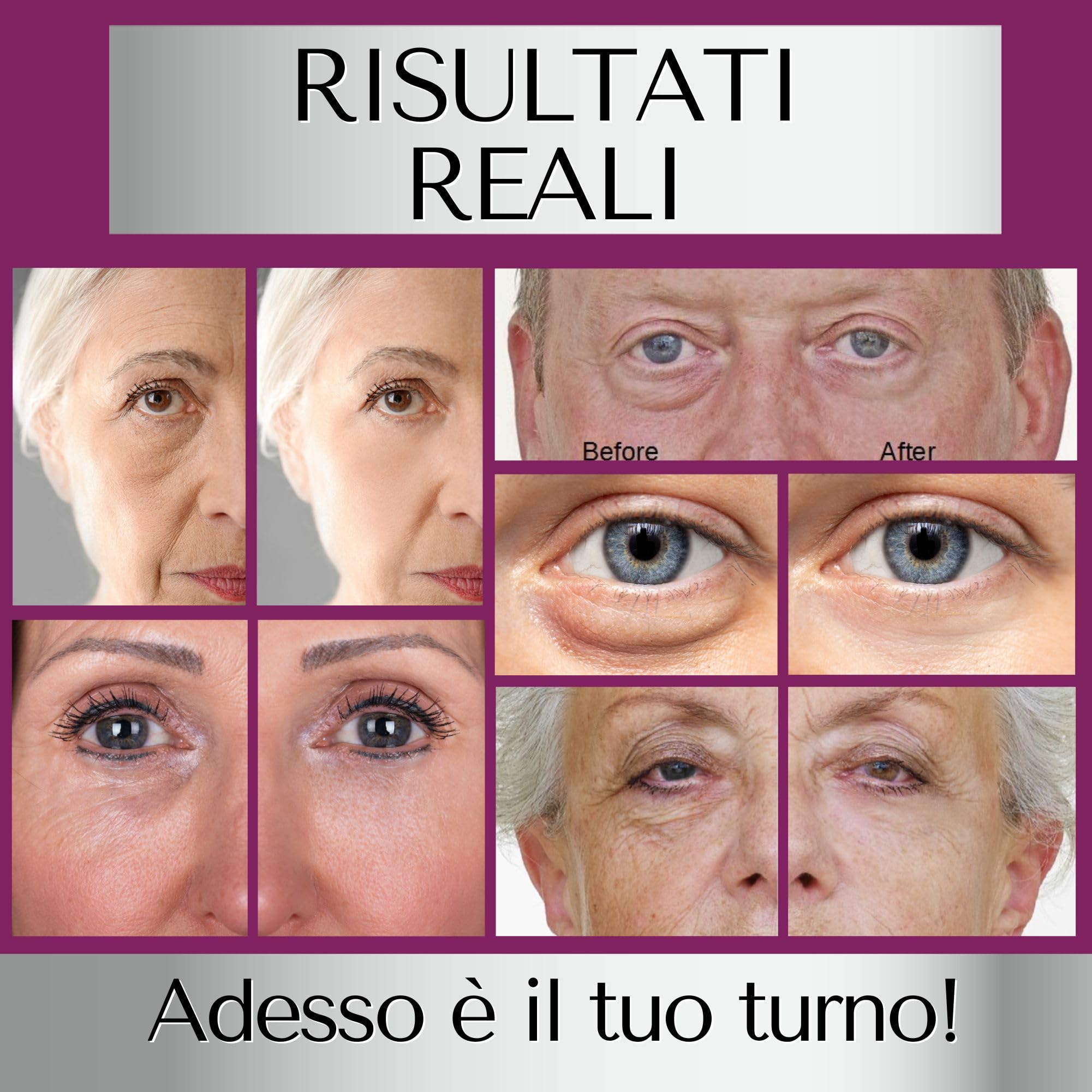 IMMACULIFT Crema Contorno Occhi Antirughe Effetto Istantaneo - Crema Lifting Viso Immediato - Occhiaie Uomo e Donna - Lifting Istantaneo Viso - Instant Face lift - Borse Sotto gli Occhi di DERMAWORKS