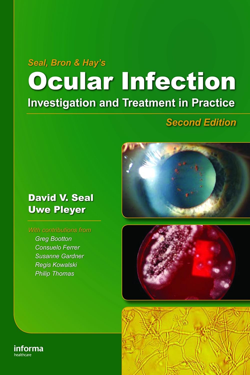 Ocular Infection: Investigation and Treatment in Practice      2nd Edition, Kindle Edition