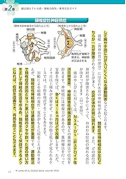 【希少品】自分で治せる!頚椎症・頚椎ヘルニア 痛みしびれ改善法 [DVD] Amazon.co.jp: 名医が教える 頚椎症 首ヘルニアを防ぐ 首の痛み