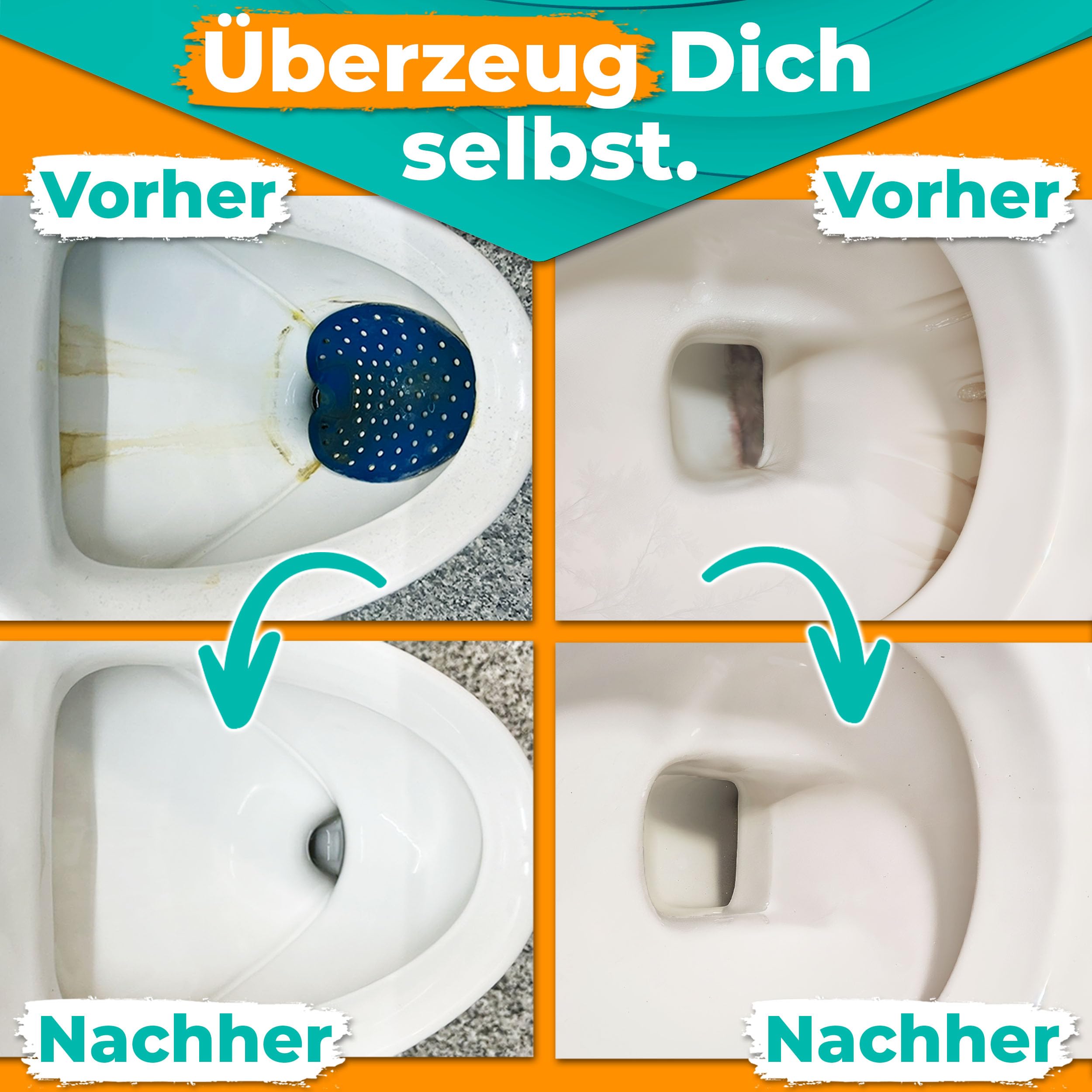 Urinsteinentferner Extra Stark, Profi Kalkentferner, Urinstein-Löser kraftvoller Krustenknacker für WC, Urinal und Bad (5 Liter + Hahn)