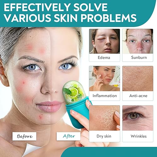 Miniatura 4 de AURUZA Juego de rodillo facial de hielo y Gua Sha, rodillo de hielo facial y herramienta de masaje Gua Sha para aliviar la hinchazón facial y