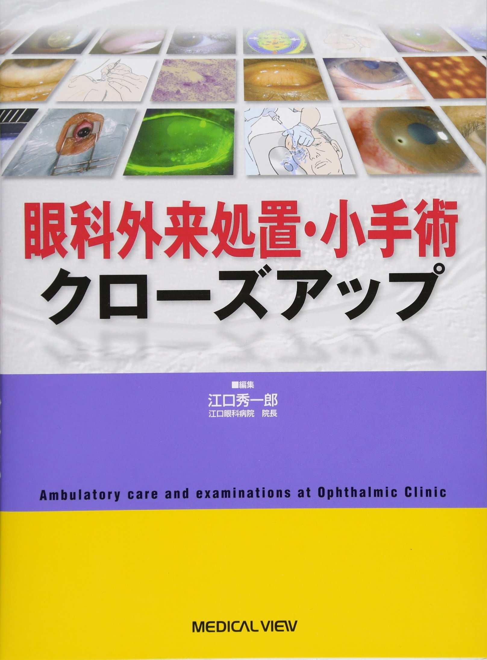 眼科外来処置・小手術クローズアップ | 江口 秀一郎 |本 | 通販 | Amazon