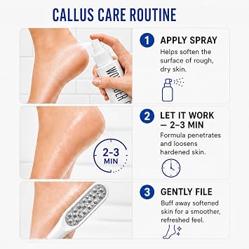 Callus Remover - Three Minutes Quick Fix- Foot File Rasp - Instant Foot Exfoliating Softener Peel Spray, Heels Callus Scrubber File - Home Spa Pedicure Treatment. Wonder Pedi