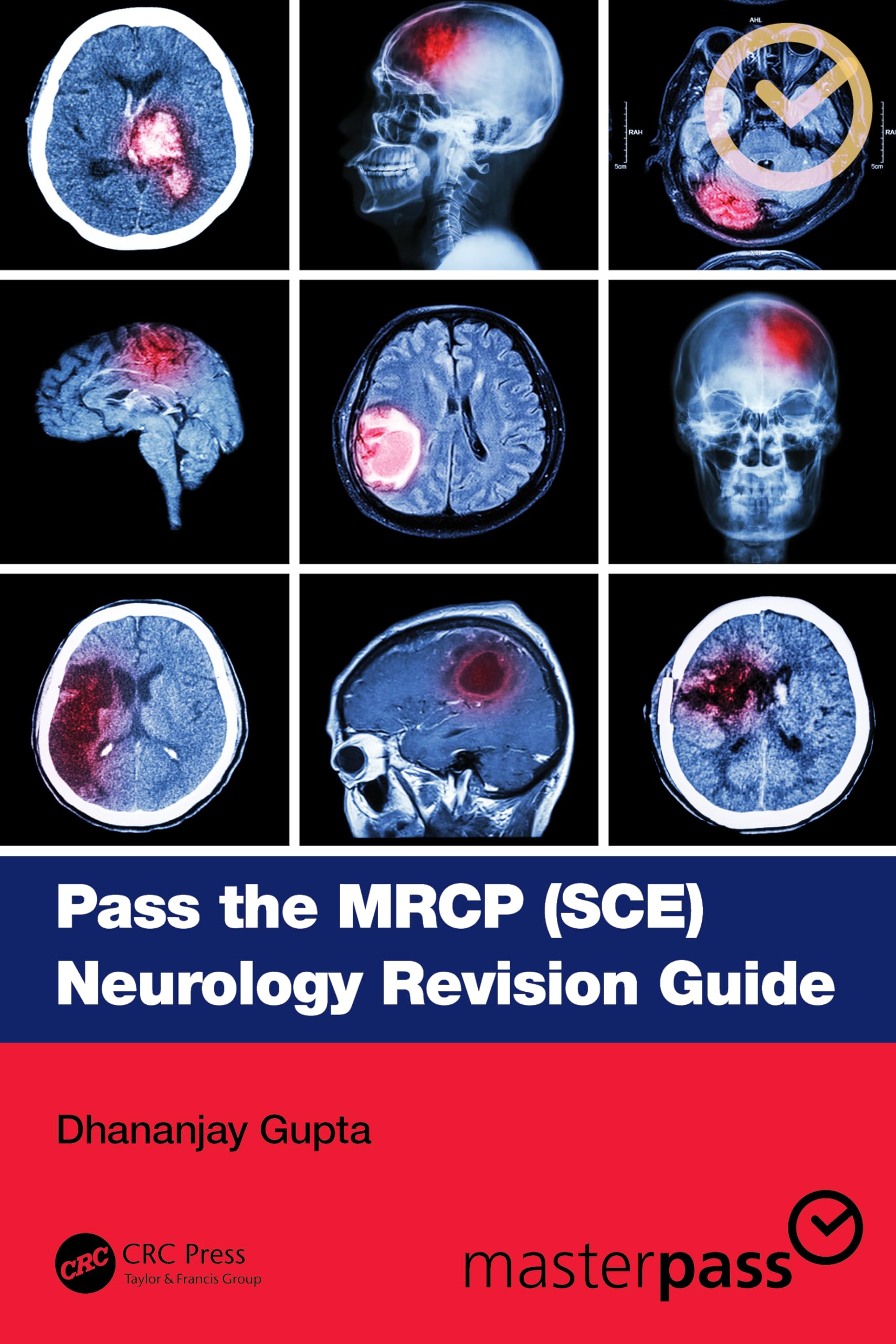 Pass the MRCP (SCE) Neurology Revision Guide