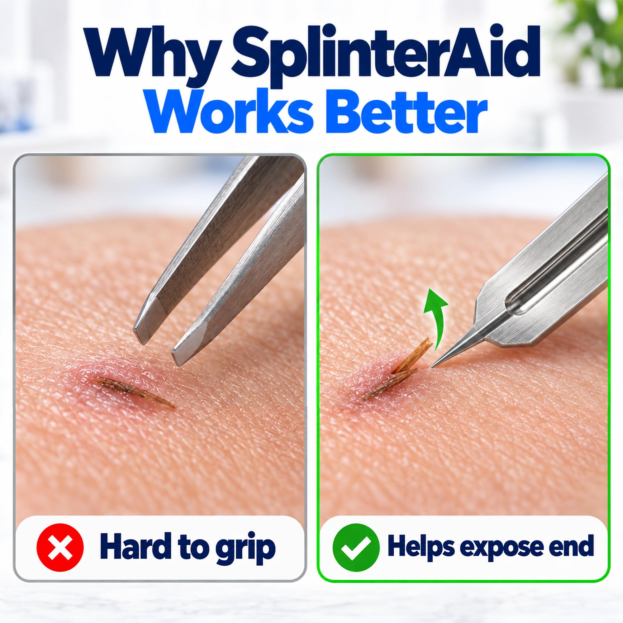 SplinterAid Splinter Removal Kit, 30 Ct Pull Out Splinters, Sliver Remover — Amazon image 3
