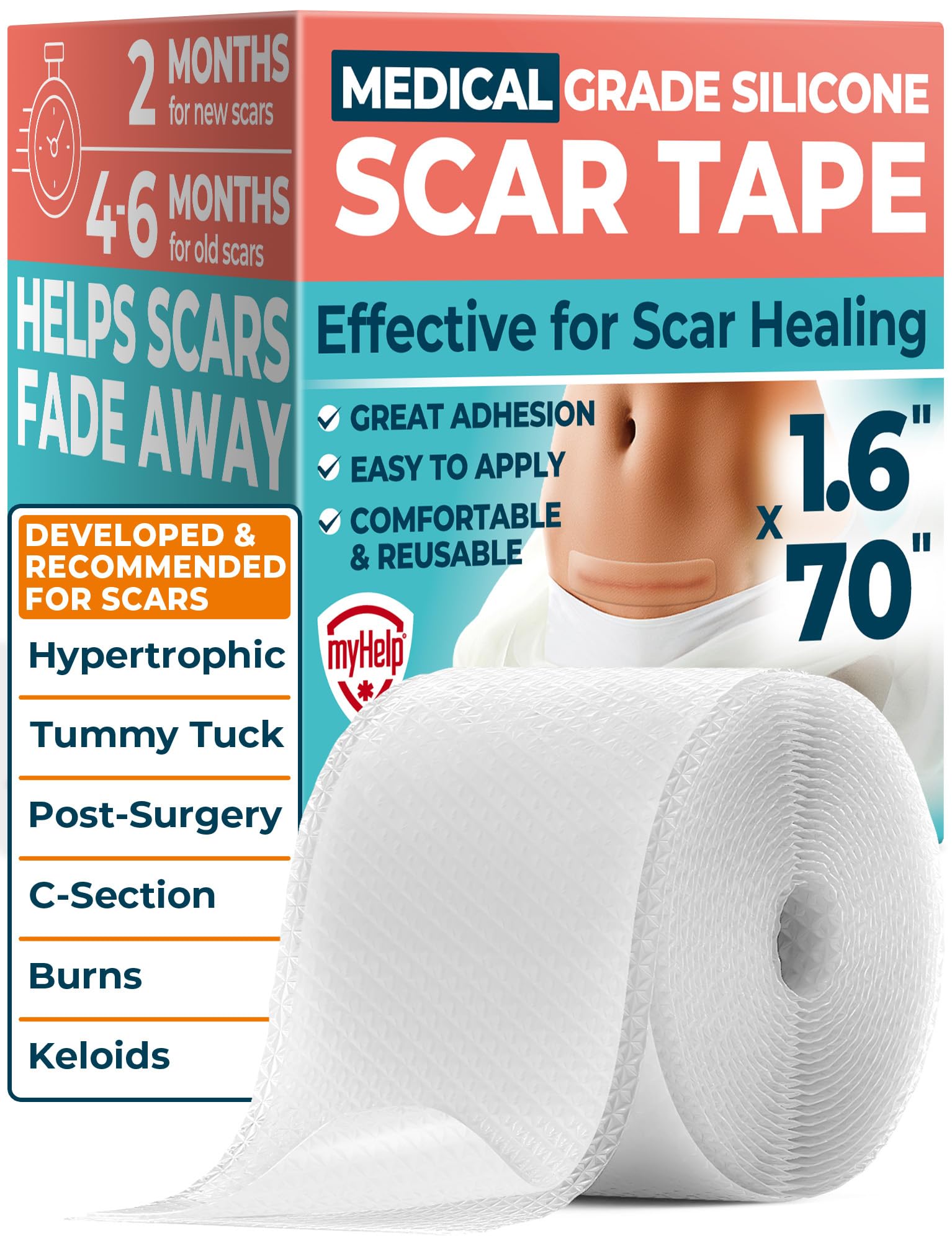 Nastro per cicatrici in silicone di grado medico, 4,1 x 177,8 cm, efficace rimozione di cicatrici chirurgiche, cheloidi, sezione C, addominoplastica, ipertrofiche e cicatrici da acne, trattamento