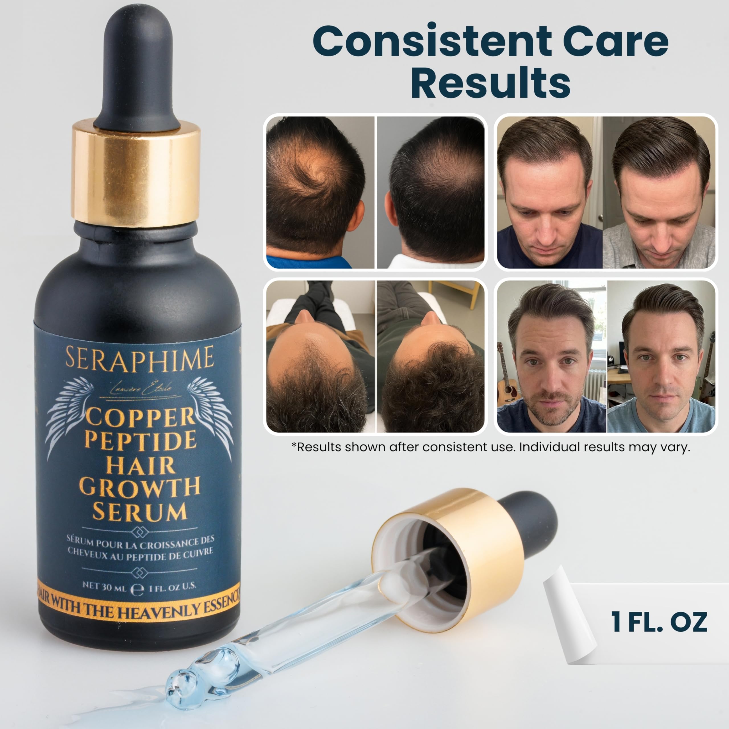 Seraphime Copper Peptide Serum for Hair, 2% GHK-CU for Hair Growth, 1 floz