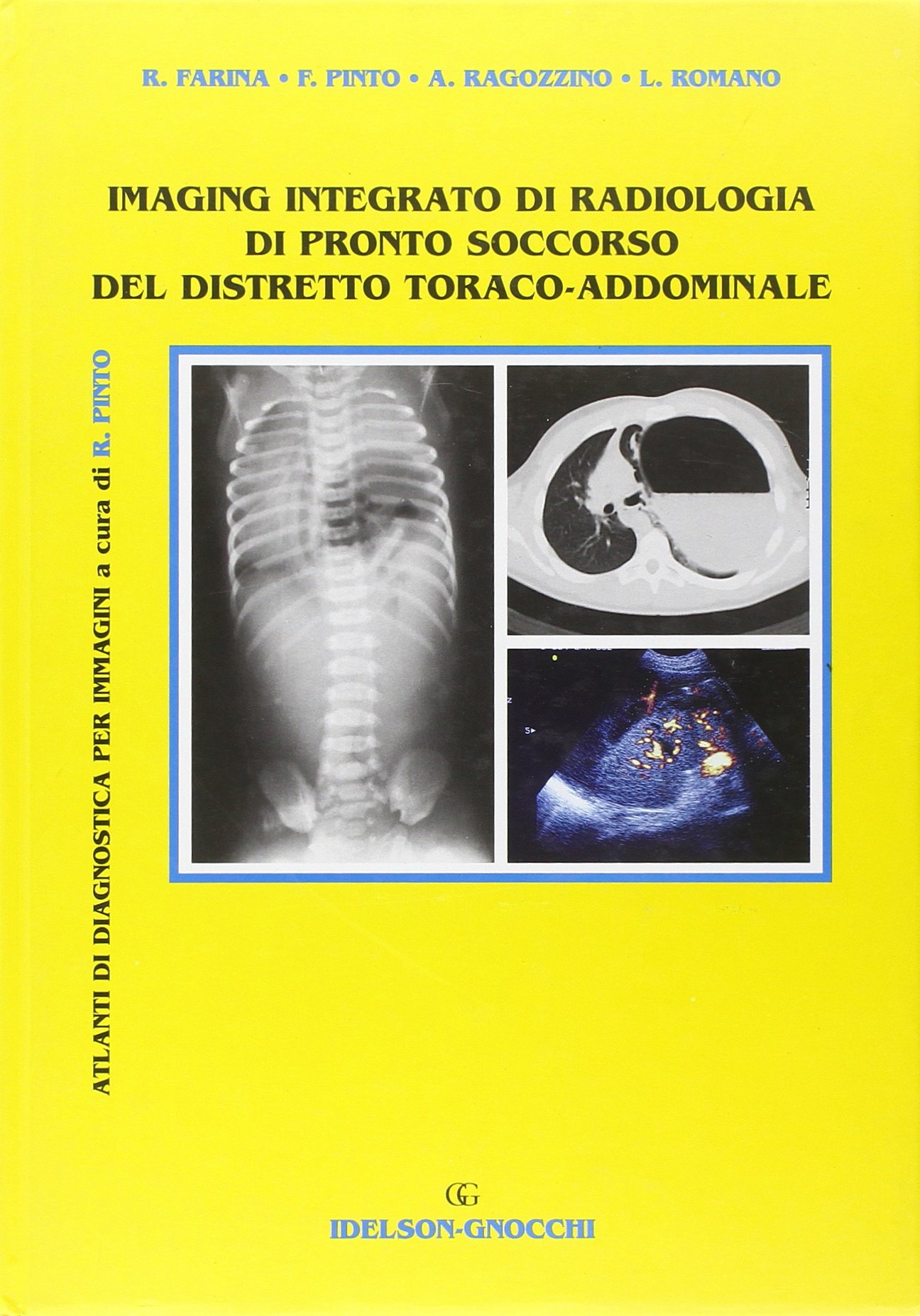 Imaging integrato di radiologia di pronto soccorso del distretto toraco-addominale