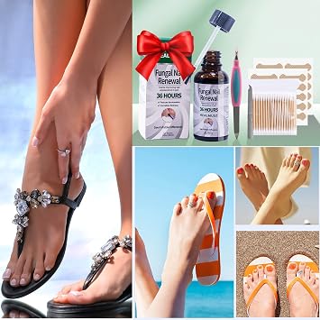 Fungal Nail Treatment: 30ml Nail Fungus Treatment for Toenail Infection Ingrown Split - Nail Repair Kit with 20Pcs Fungal Nail Patches/Double-Ended Nail File/100Pcs Double-Ended Cotton Swabs