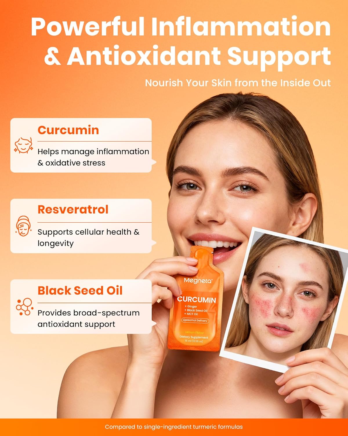 Liposomal Turmeric Curcumin Ginger Liquid Supplement– Extra Strength with Black Seed Oil, MCT& Resveratrol – Maximum Absorption, Joint & Inflammation Support, Antioxidant & Cellular Health