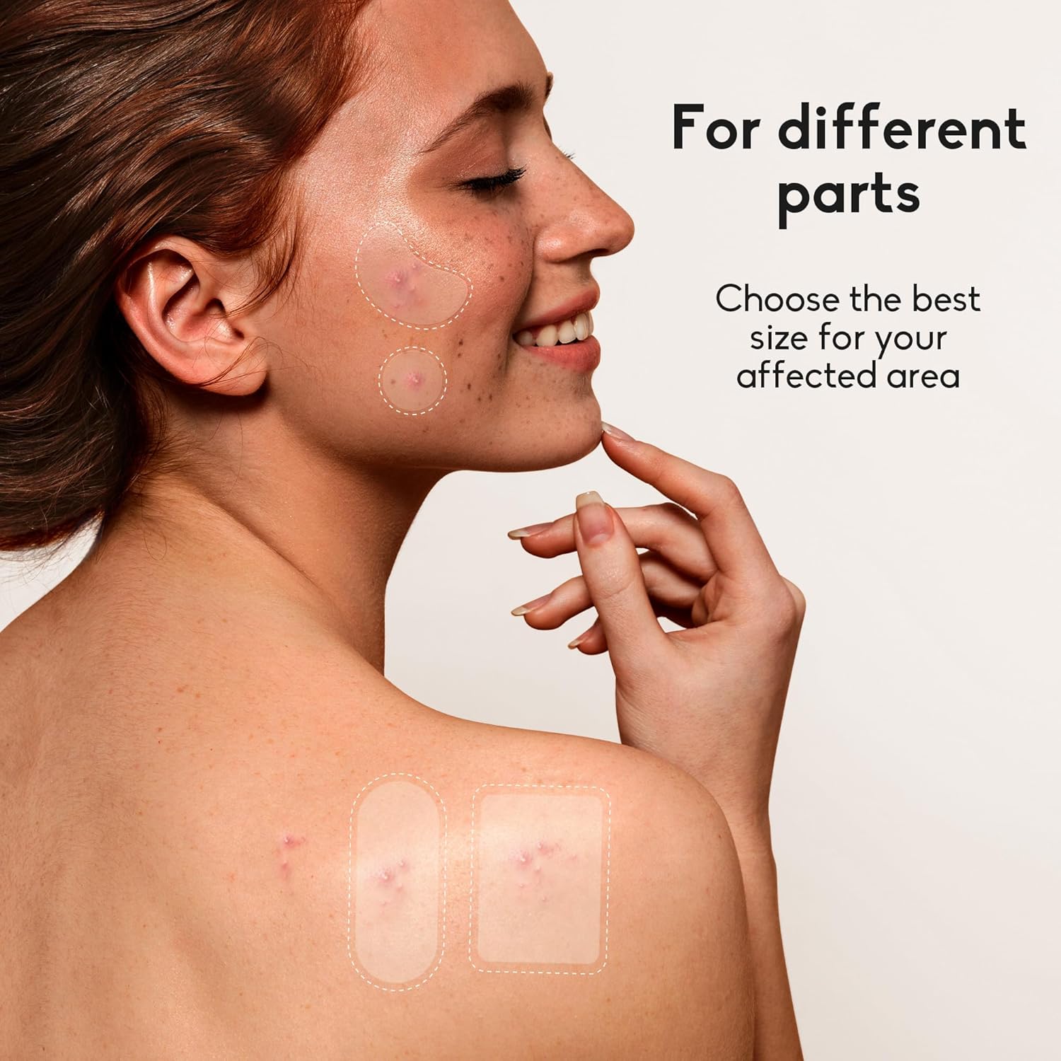 XL Hydrocolloid Acne Patches: 6 Sizes, Fast Healing! 4 81v3ceMj +L. SL1500