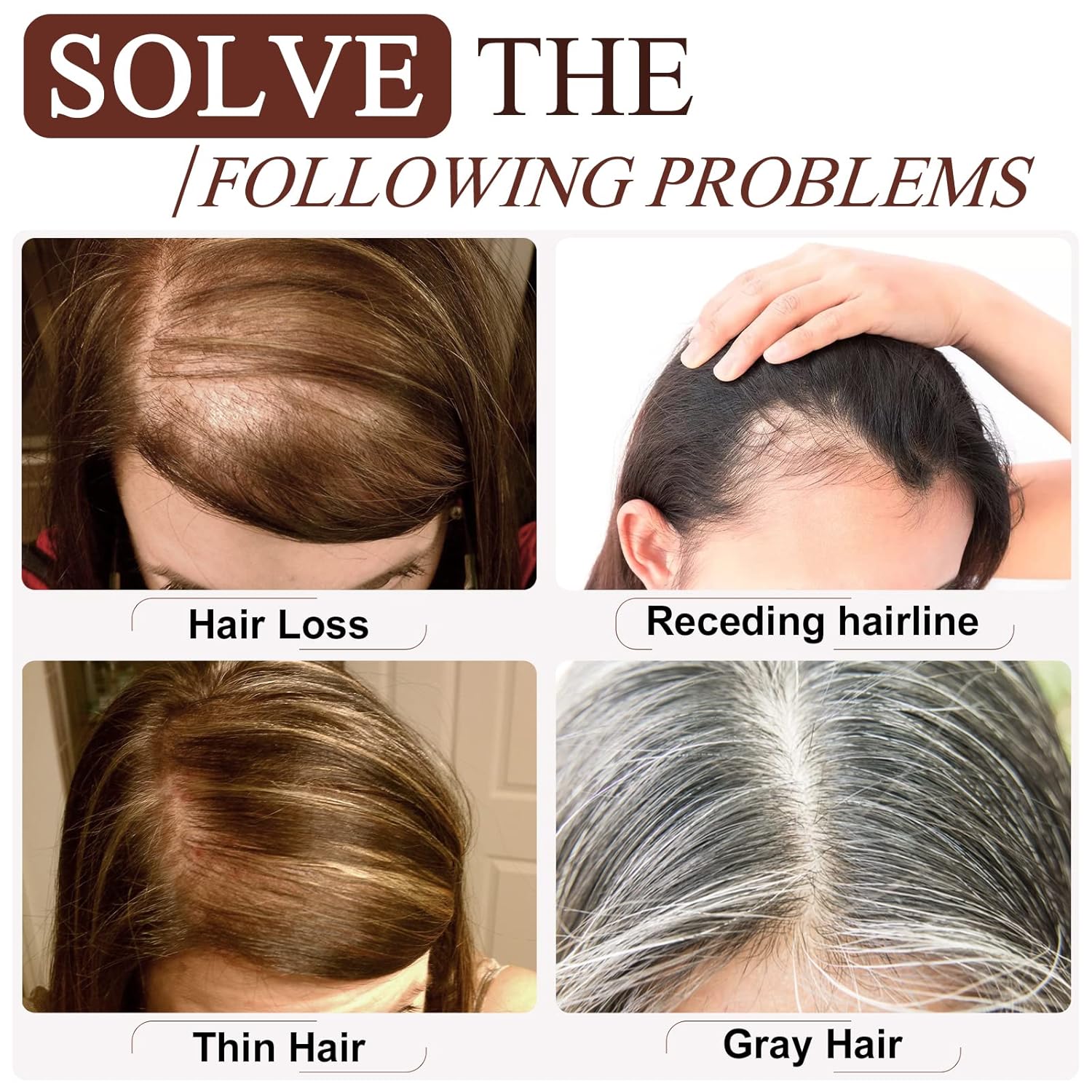 SEGO Real Human Hair Topper for Women, No Bangs Hair Topper with Anti-Slip Clips (18 Inches Dark Brown)