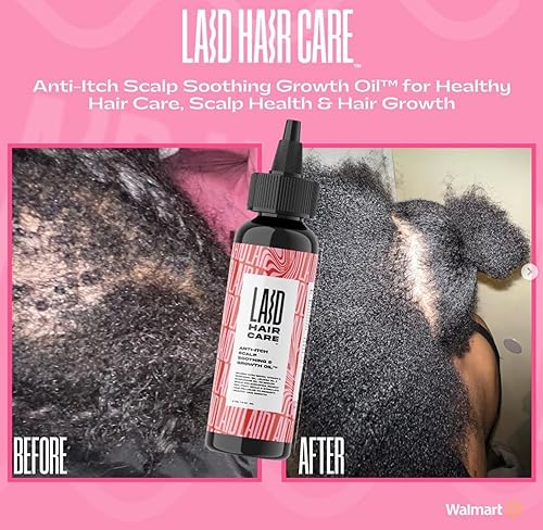 Miniatura 2 de Aceite de crecimiento calmante para el cuero cabelludo antipicazón