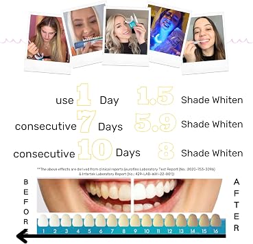 Sparkle Booster Teeth Whitening Kit - 2 x 5ml Pap Whitening Gel Syringes - Includes Rechargeable LED Whitening Device, Shade Guide & Remineralization Pen - 10 to 15 Days Treatment