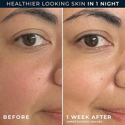 Miniatura 5 de RoC Barrier Renew Crema hidratante nocturna con ceramidas y té verde antioxidante y péptidos lipo para renovar la barrera de la piel, (2.5 onzas)