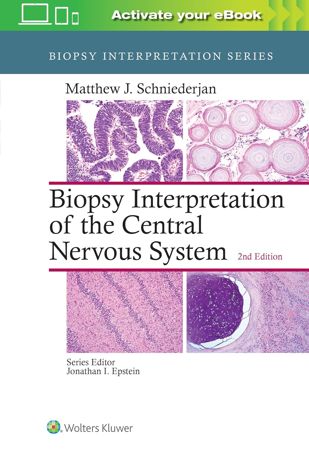 BIOPSY INTERPRETATION OF THE  CENTRAL NERVOUS SYSTEM 2ED