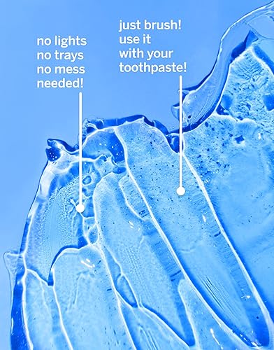 Miniatura 5 de Supersmile Acelerador de blanqueamiento profesional, potente blanqueamiento sin sensibilidad, seguro y eficaz en restauraciones dentales (3.6 onzas)