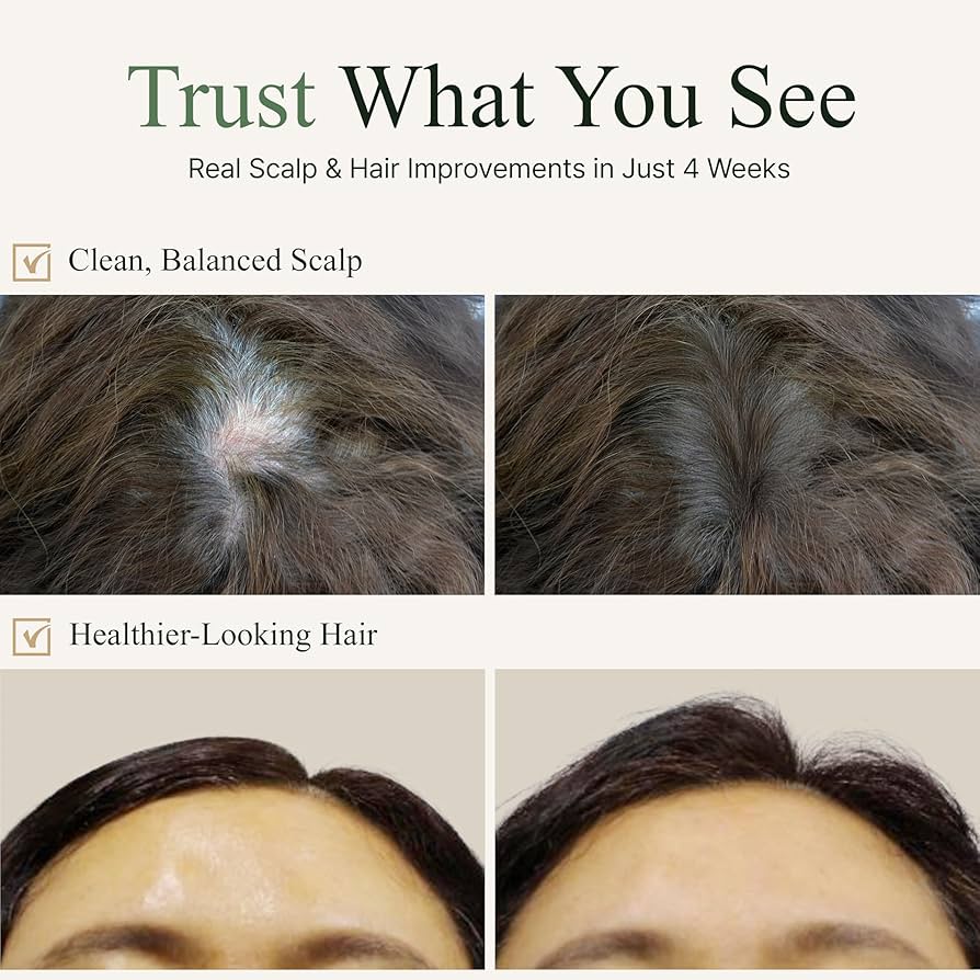 シャンプー Ts Amazon | 【TS公式】TS シャンプー ゴールドプラスシャンプー