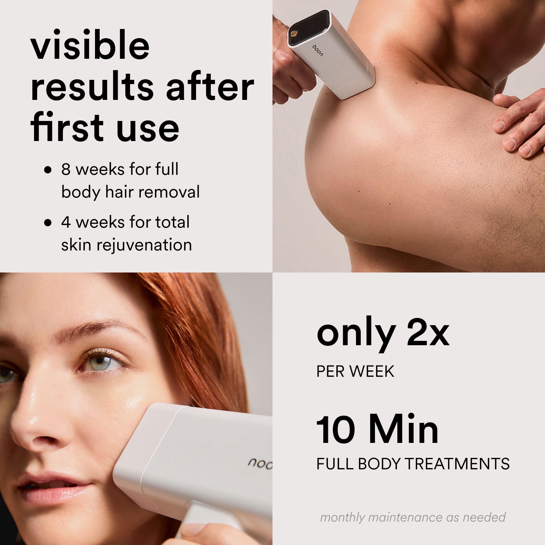 NEW Nood™ Flasher Pro — IPL Laser Hair Removal Device for Women & Men with Sapphire Cooling — Pain-free & Permanent, Visible Results After First Use & Works Everywhere Hair Grows — Gloss White