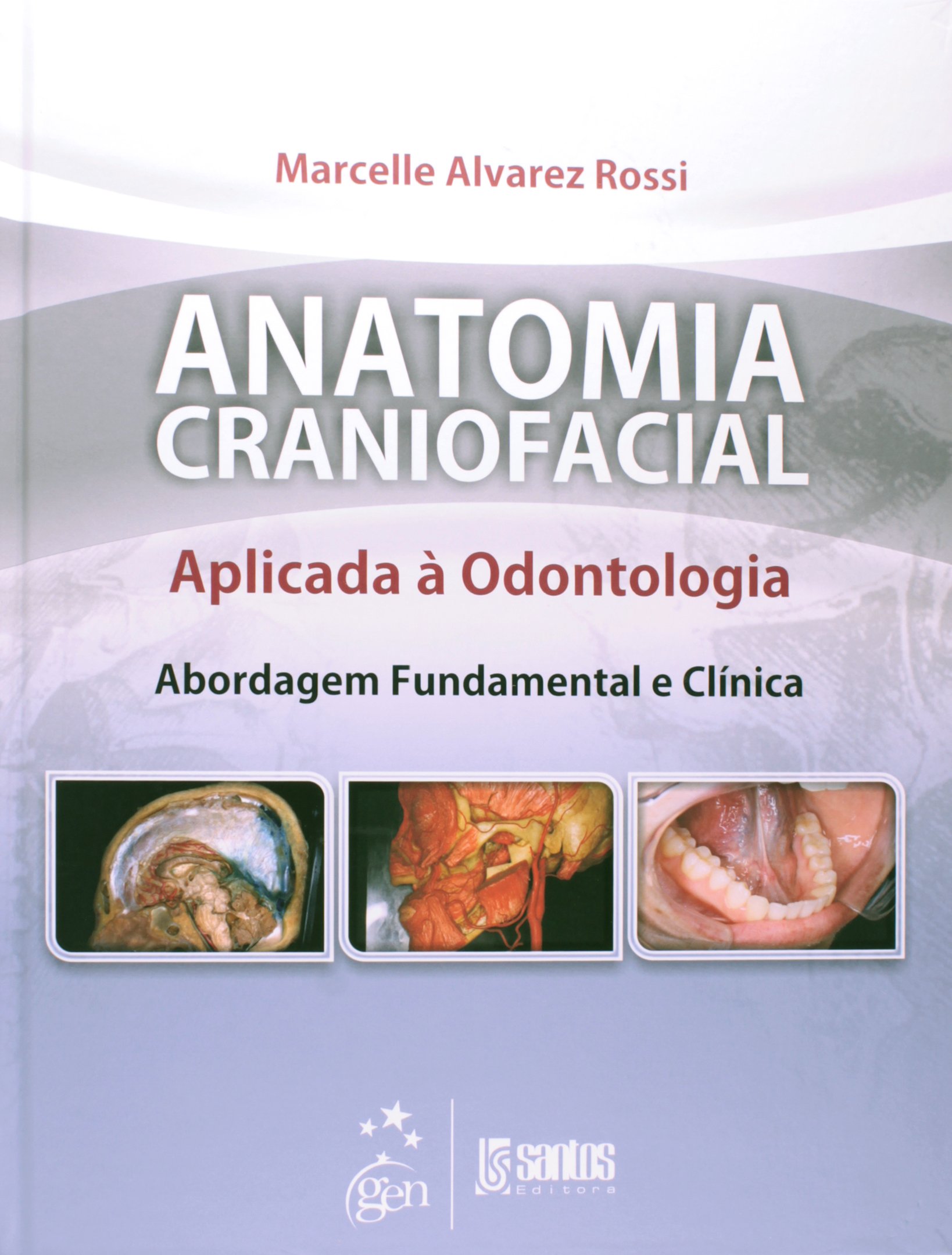 Anatomia Craniofacil Aplicada A Odontologia. Abordagem Fundamental E Clinica (Em Portuguese do Brasil)