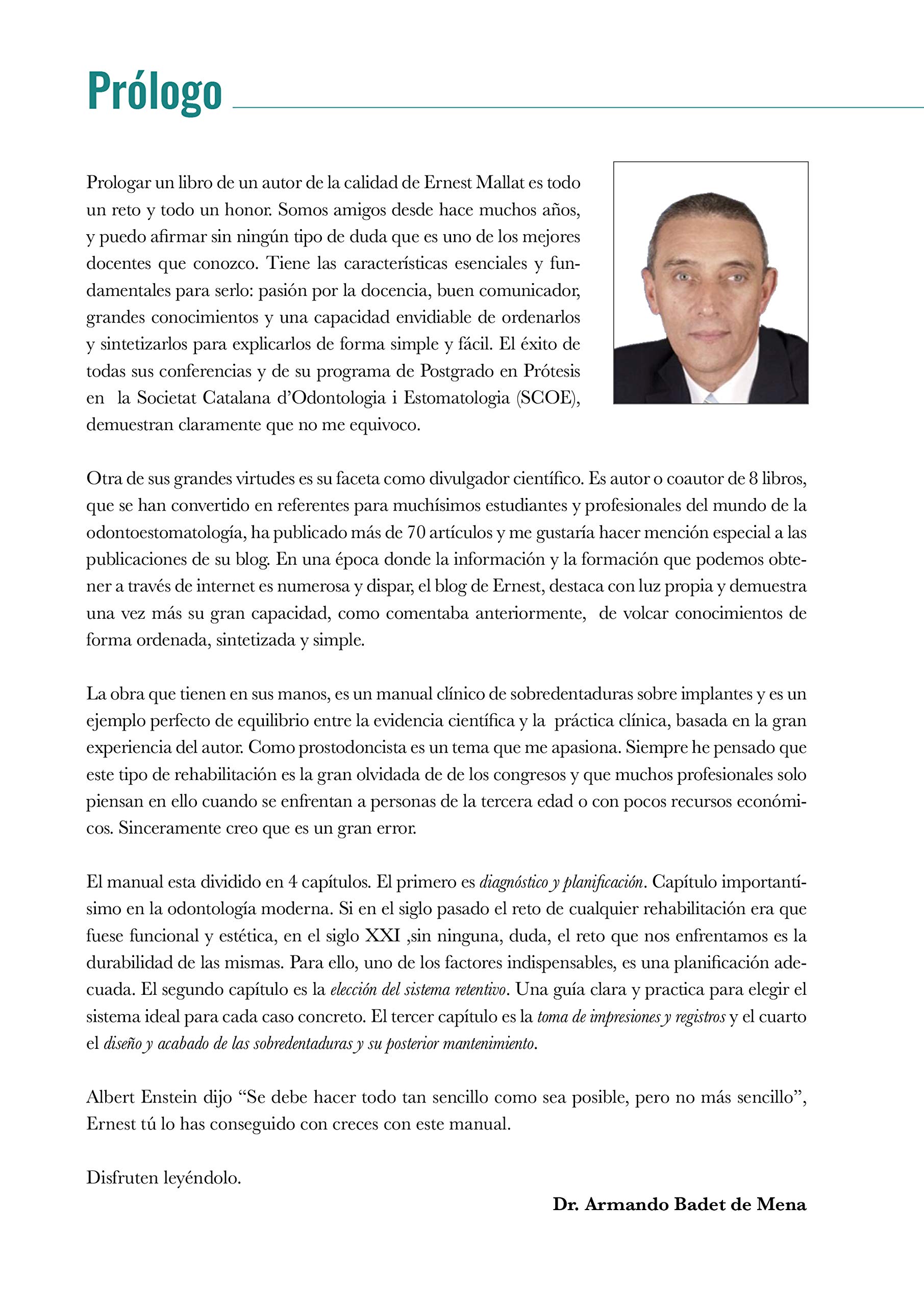 Sobredentaduras sobre implantes: Manual Clínico