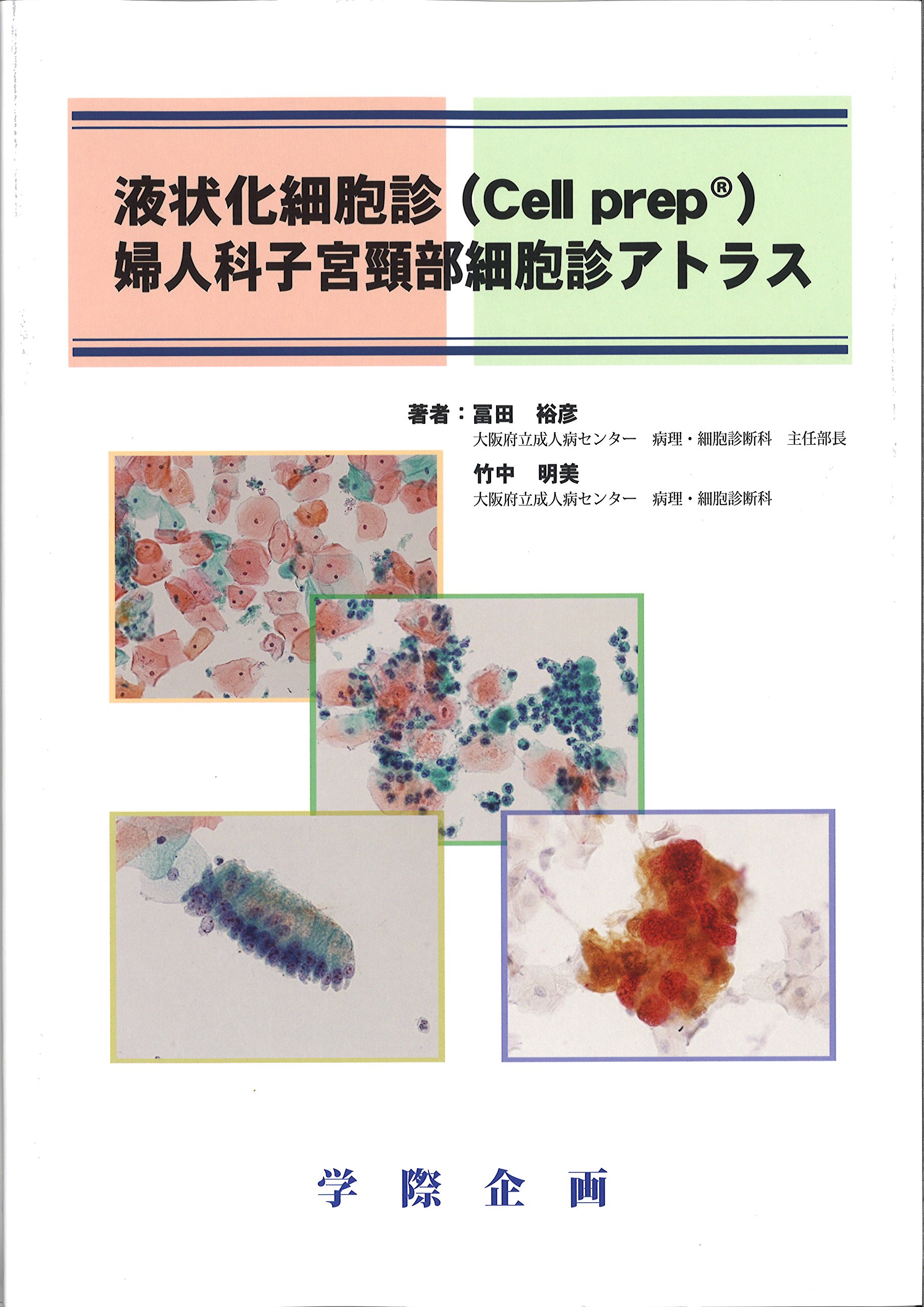 液状化細胞診(Cell prep)婦人科子宮頚部細胞診アトラス | 冨田 裕彦