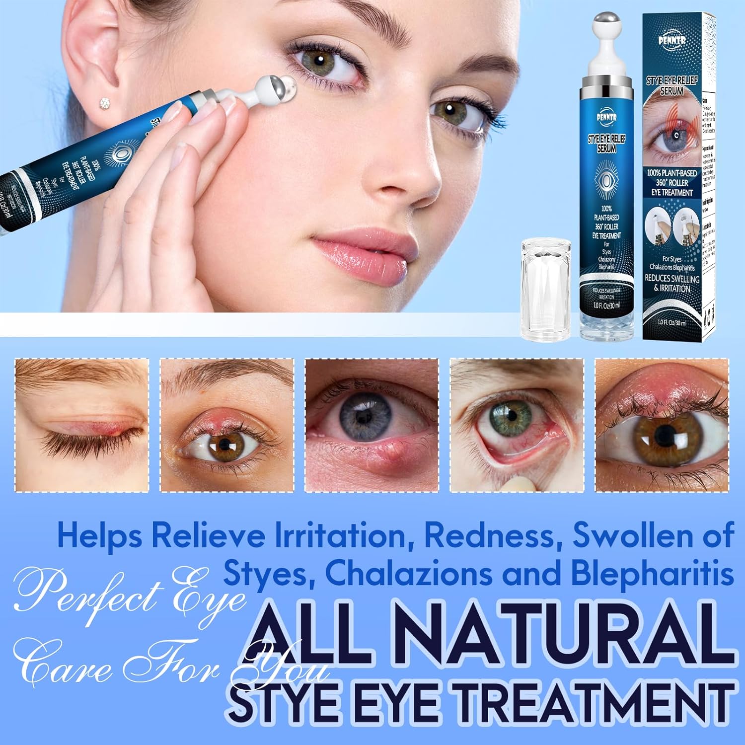 Stye Eye Treatment, Eye Serum for Stye, Chalazions & Blepharitis Roller Serum, Natural and Plant-based Formula (1 Fl Oz) - Image 3