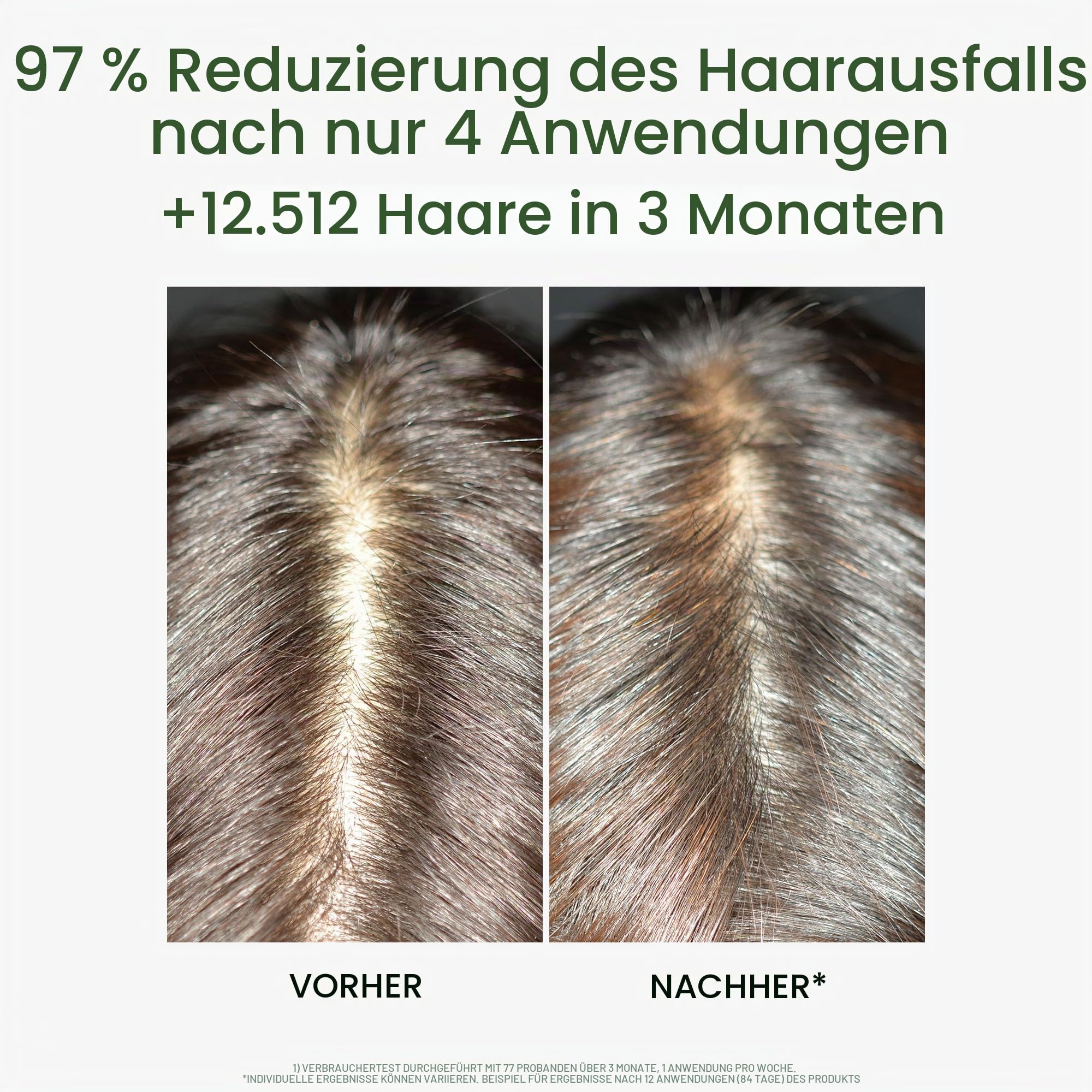 Rene Furterer Triphasic Anti-Hair Loss Rf80 Treatment 12 Vials