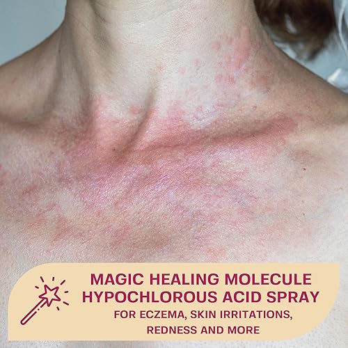 Miniatura 3 de Base Labs - Spray de ácido hipocloroso  Limpiador en aerosol curativo de la piel para heridas tratamiento de eccema cuidado posterior de tatuajes y