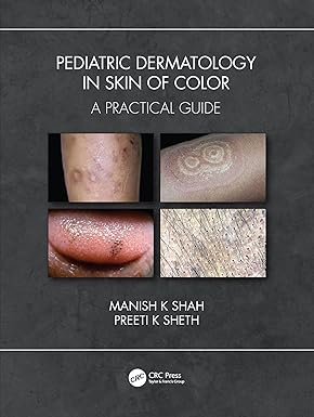 PEDIATRIC DERMATOLOGY IN SKIN OF COLOR A PRACTICAL GUIDE (PB 2021)