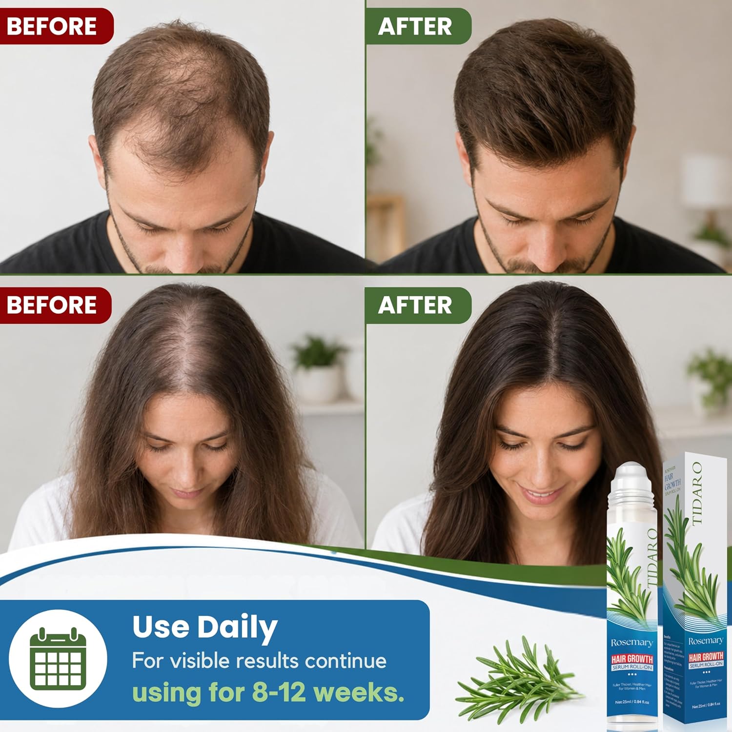 Premium Hair Growth Booster 25ml Organic Serum Oil Roll On Acetyl Tetrapeptide 3% Biotinoyl Tripeptide1% Vitamin B7 Women & Men Anti Loss Furmula Strenghens Roots Scalp with Rosemary