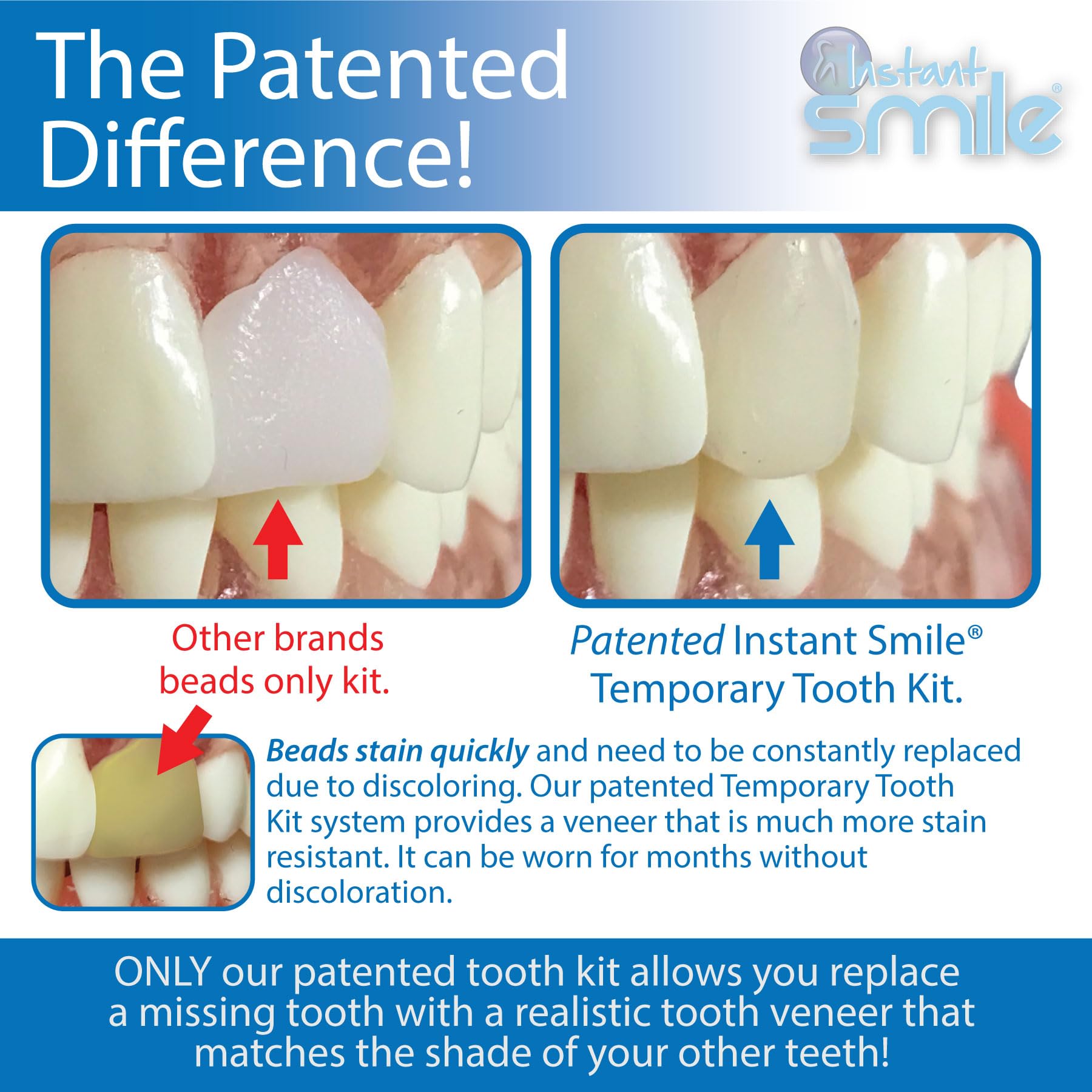 ATOPI SMILE f. 3点セット Amazon.com : Instant Smile Pro Series Temporary Tooth Kit - With