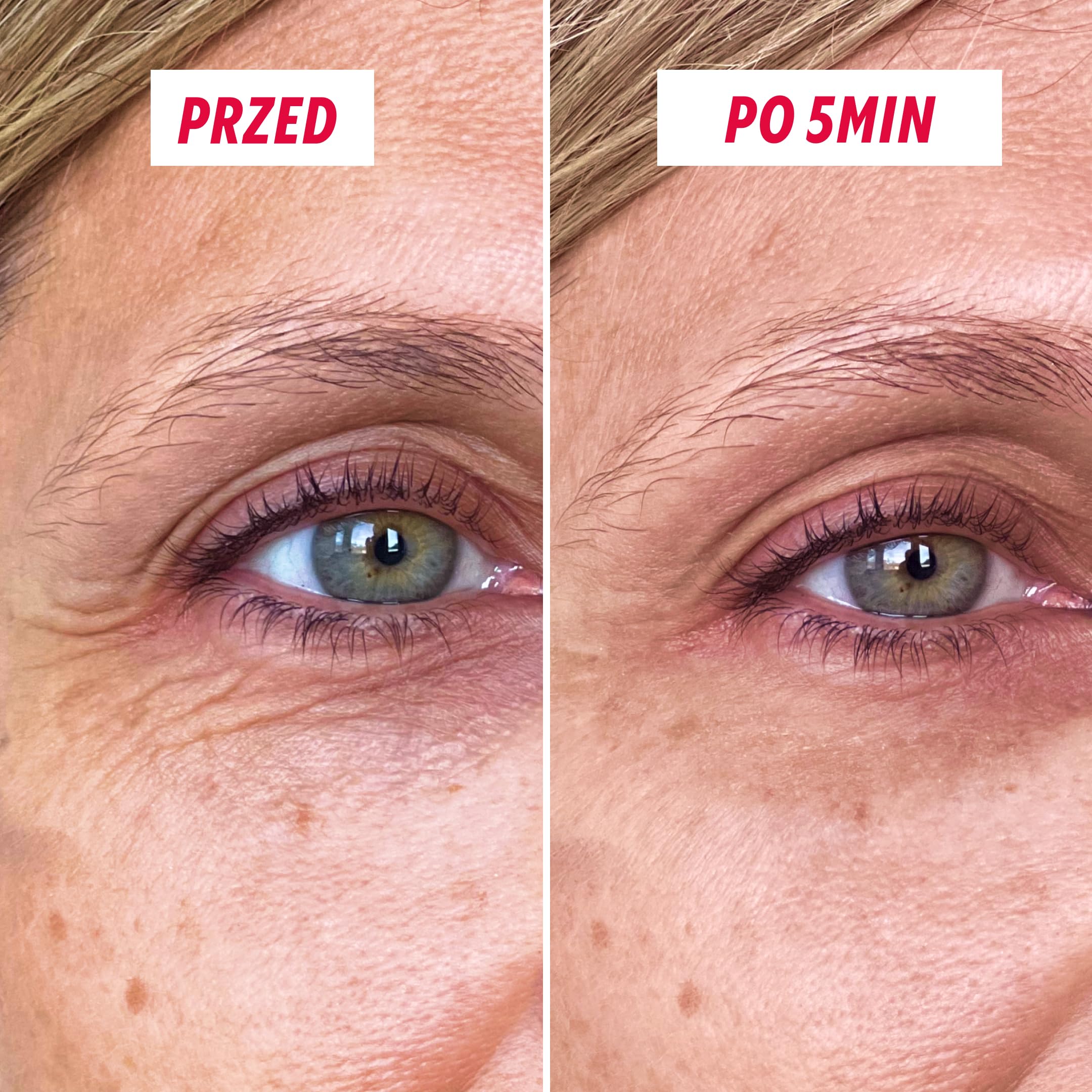 MYSOSBEAUTY wypełniacz zmarszczek – korektor zmarszczek – tymczasowy krem liftingujący do konturów oczu zapobiegający starzeniu się skóry – natychmiastowa pielęgnacja liftingowa na 8 godzin – redukuje