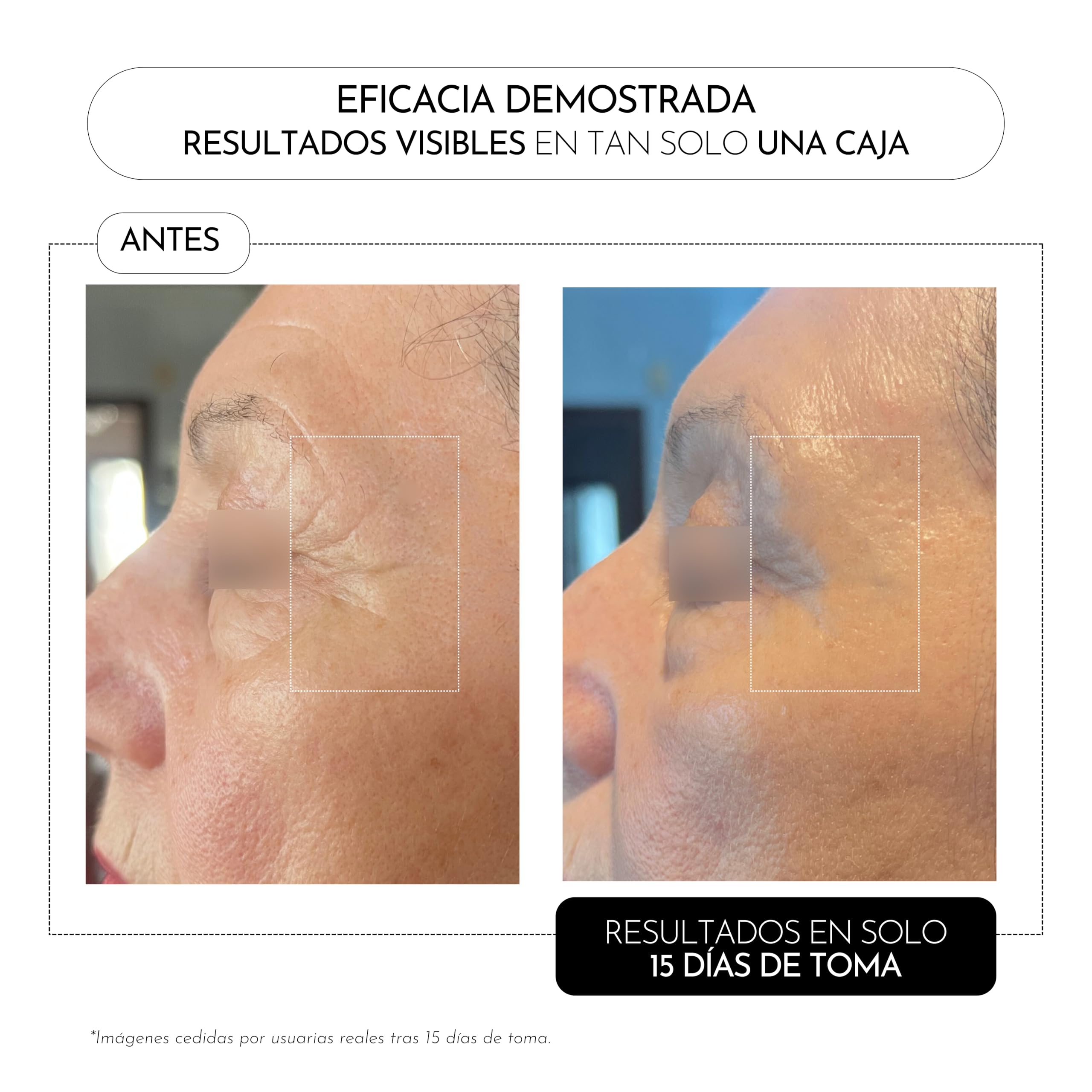 LUXMETIQUE® ProAge Ritual Rejuvenecimiento - Pack Fórmula Día + Noche