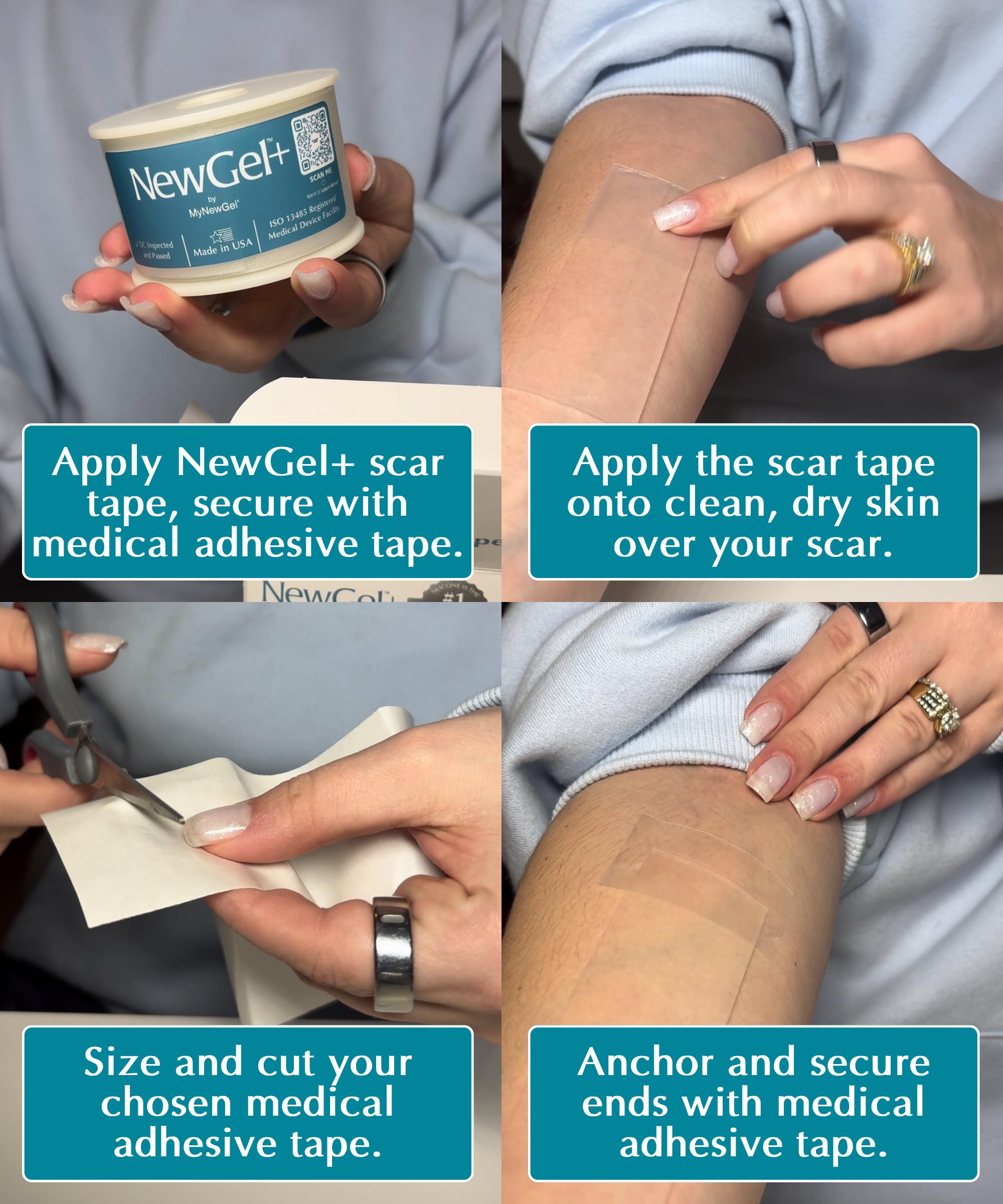 NewGel Plus - Rotolo di nastro per cicatrici in silicone 100% di grado medico, per chirurgia, taglio cesareo, cicatrici da cheloidi e acne, nastro in silicone riutilizzabile extra spesso da 1 mm