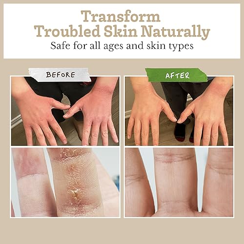 Miniatura 5 de Southern Natural Barra de jabón de leche de cabra  Paquete de 3 unidades de romero y menta  para pieles sensibles secas. Jabón natural hecho a mano