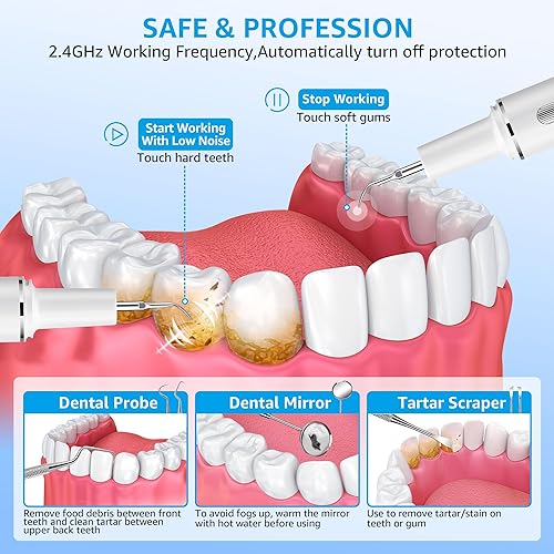 Miniatura 4 de Kit de limpieza de dientes, removedor de placa para dientes, herramienta portátil para quitar placa dental con LED, blasador de placa para dientes