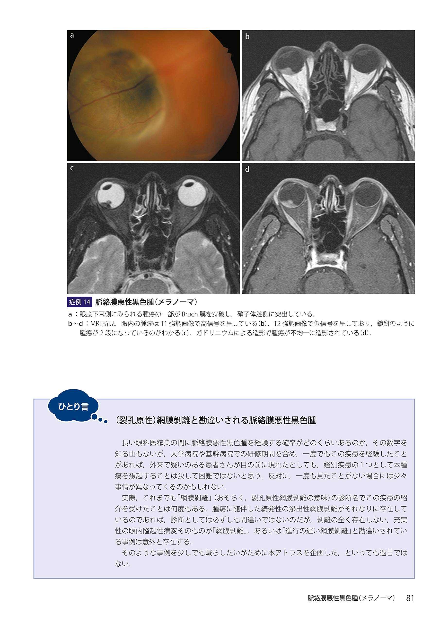 予約 眼内腫瘍アトラス 新品 rauquen.cl