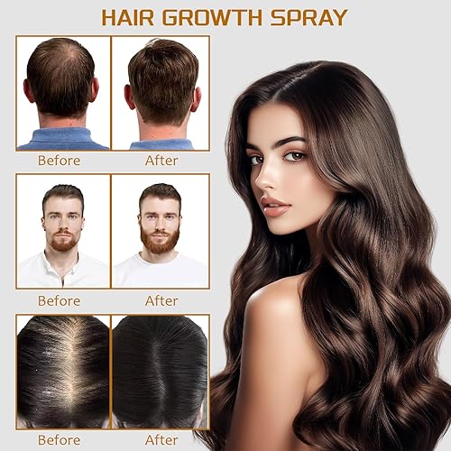 Miniatura 4 de Spray de minoxidil al 5% con biotina de 3.4 fl oz, tratamiento de recrecimiento para hombres y mujeres, promueve el cabello más grueso, más fuerte y