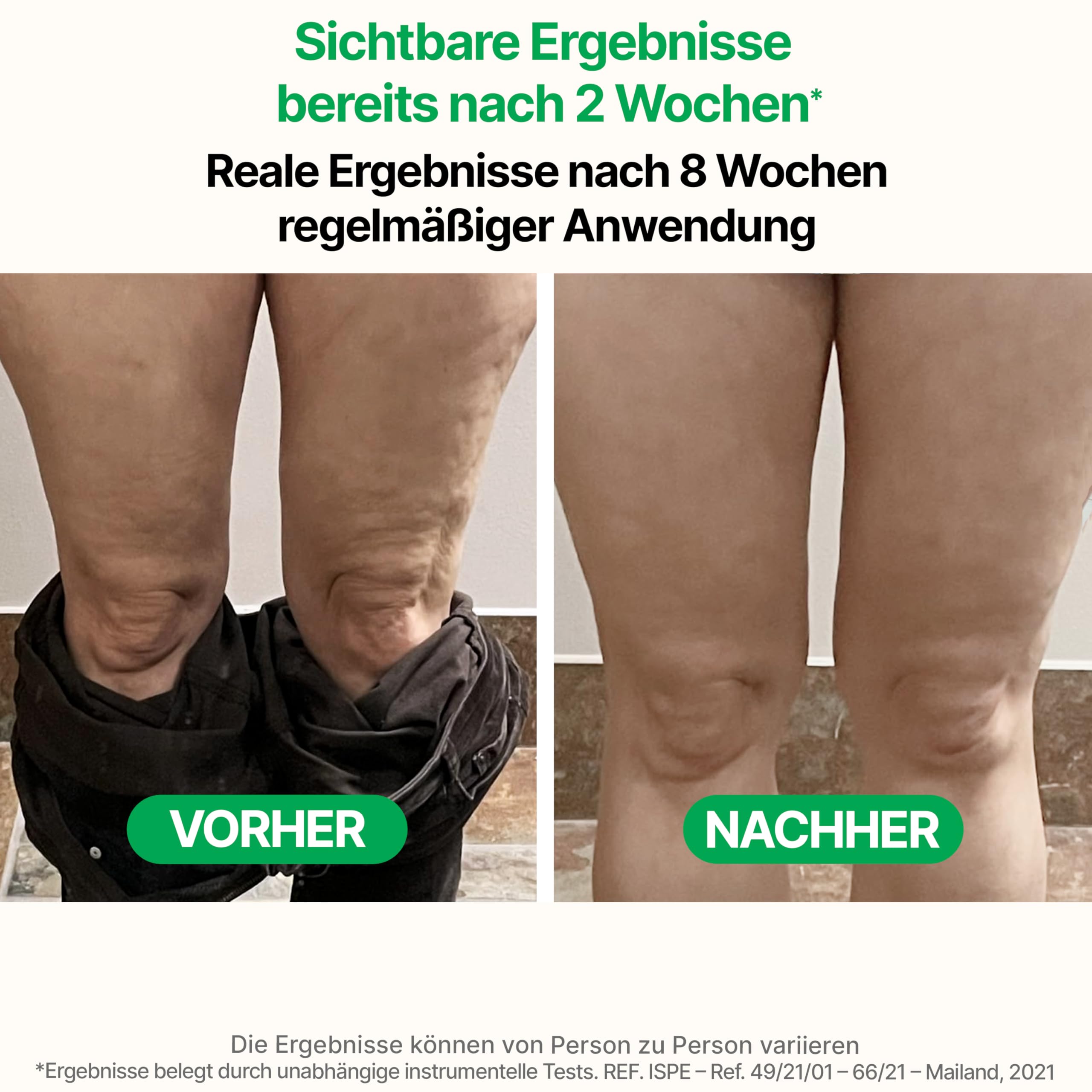 TESMED Anti-Cellulite Massagegerät Manuell Patentiert Roller für Oberschenkel Gesäß Hautstraffung Made in Italy