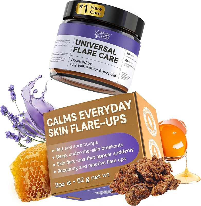 MyMagicHealer Universal Flare Care Creme Corporal 2 oz