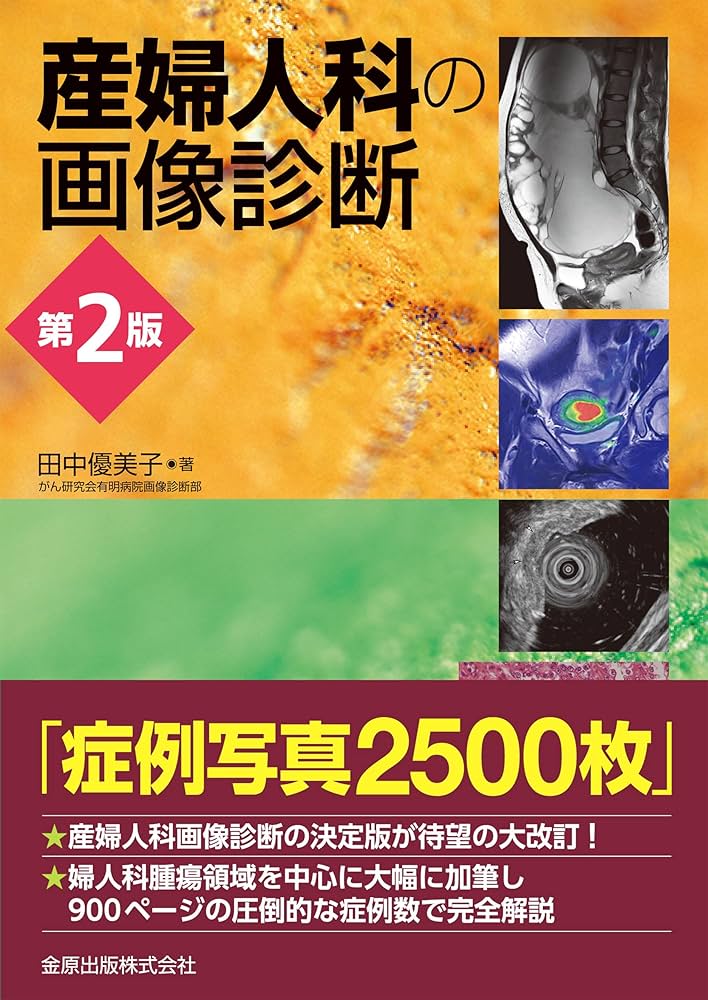 産婦人科の画像診断 第2版 | 田中 優美子 |本 | 通販 | Amazon
