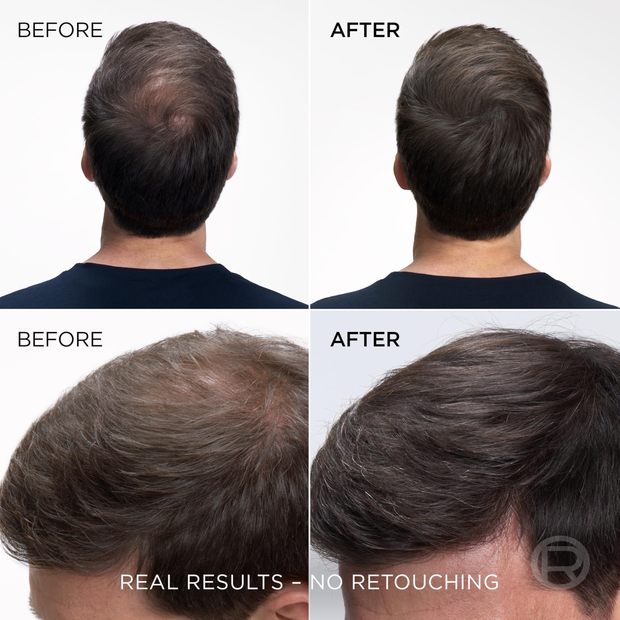 L'Oreal Paris Magic Retouch